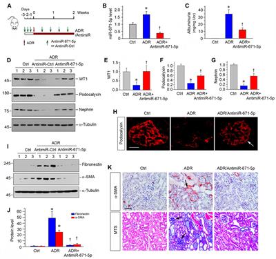 Role of miRNA-671-5p in Mediating Wnt/β-Catenin-Triggered Podocyte Injury